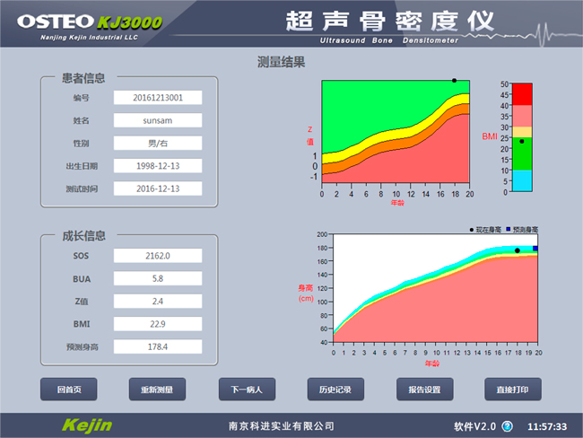 兒童骨密度檢測結果.jpg